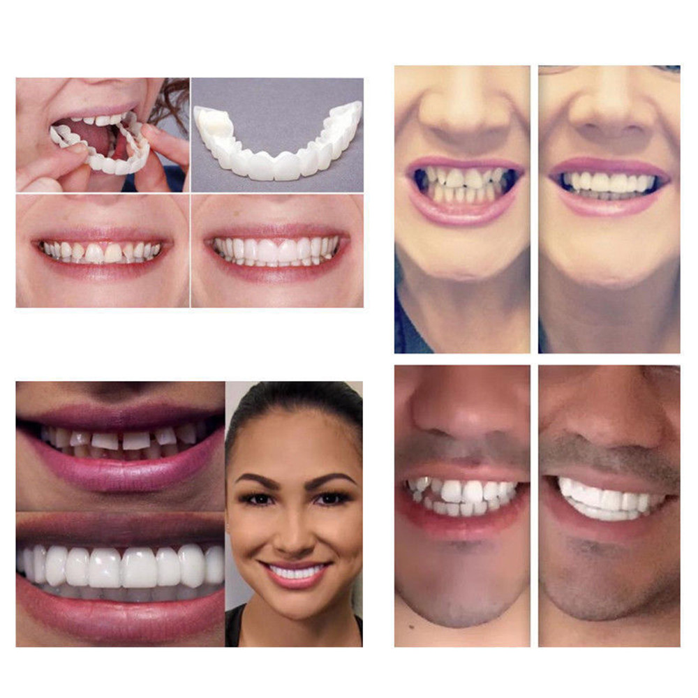 Snap On Instant Smile Perfect Smile Comfort Fit Flex Зубы подходят для виниров Улыбка- Белый